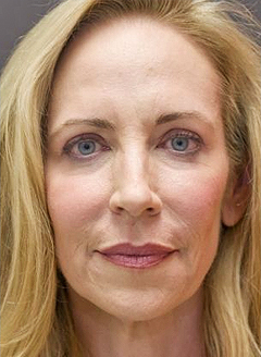 Transformation Picture After