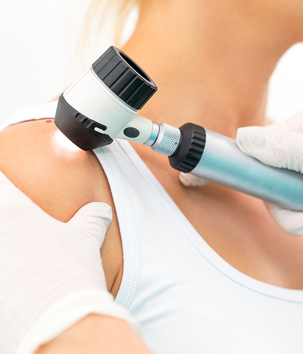 Medical Services Skin Cancer Treatment